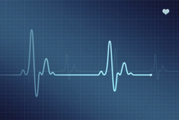 Ekg