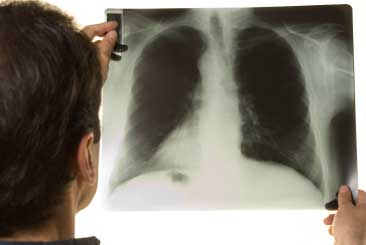 Doctor looking at x ray